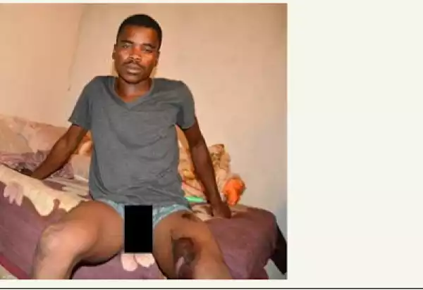 Woman Pours Hot Water On Neighbour’s Manh00d For Refusing To Sleep With Her (Photo)